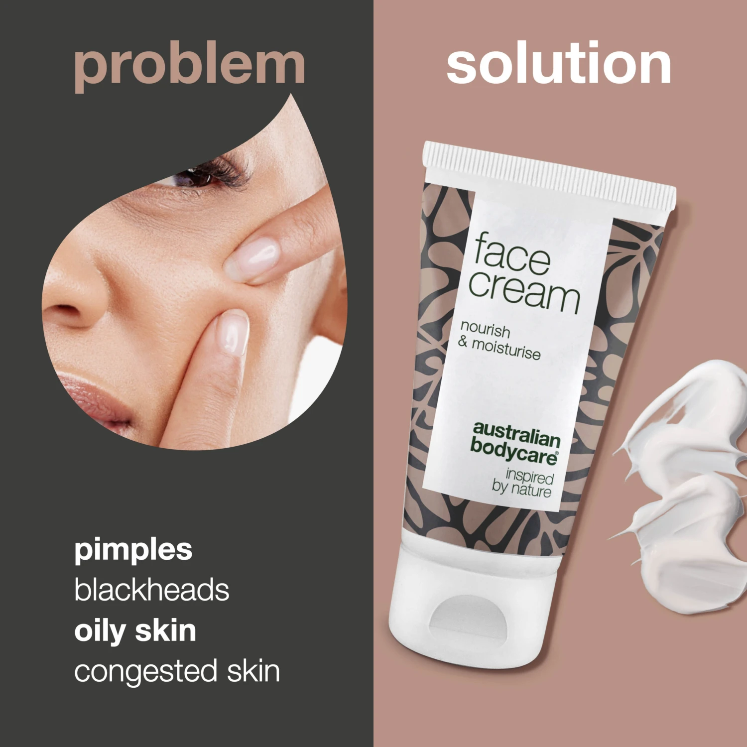 Australian Bodycare Tea Tree Face Cream For Pimples And Congested Skin β Face Moisturiser, Perfect For Spots, Pimples, Oily, And Acne Prone Skin - Image 2