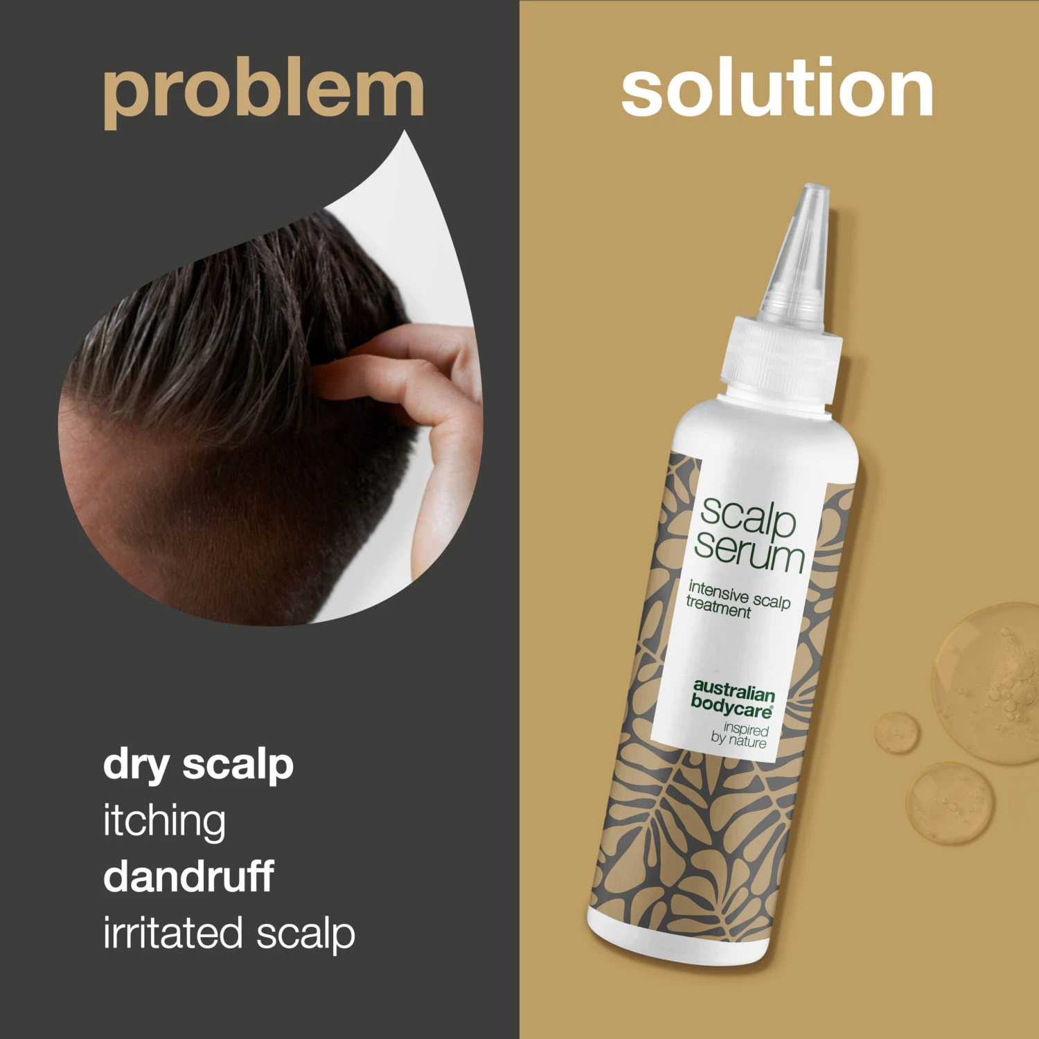 Australian Bodycare Scalp Treatment Against Dandruff And Dry Scalp β Scalp Serum For Itchy Scalp, Greasy Hair, Dry And Scalp Irritation - Image 2