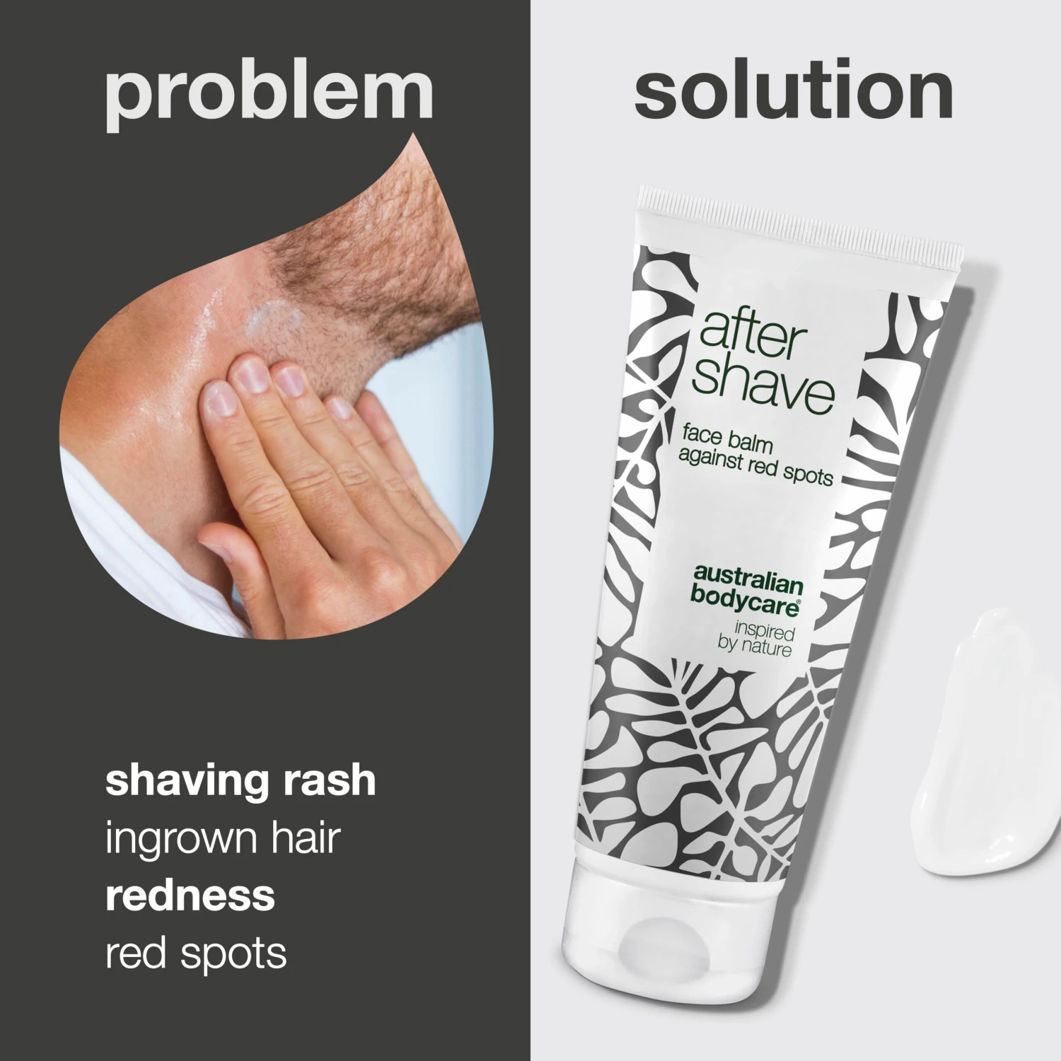Australian Bodycare After Shave Against Razor Burn And Razor Bumps — Aftershave Lotion To Prevent Shaving Rash And Ingrown Hair - Image 2