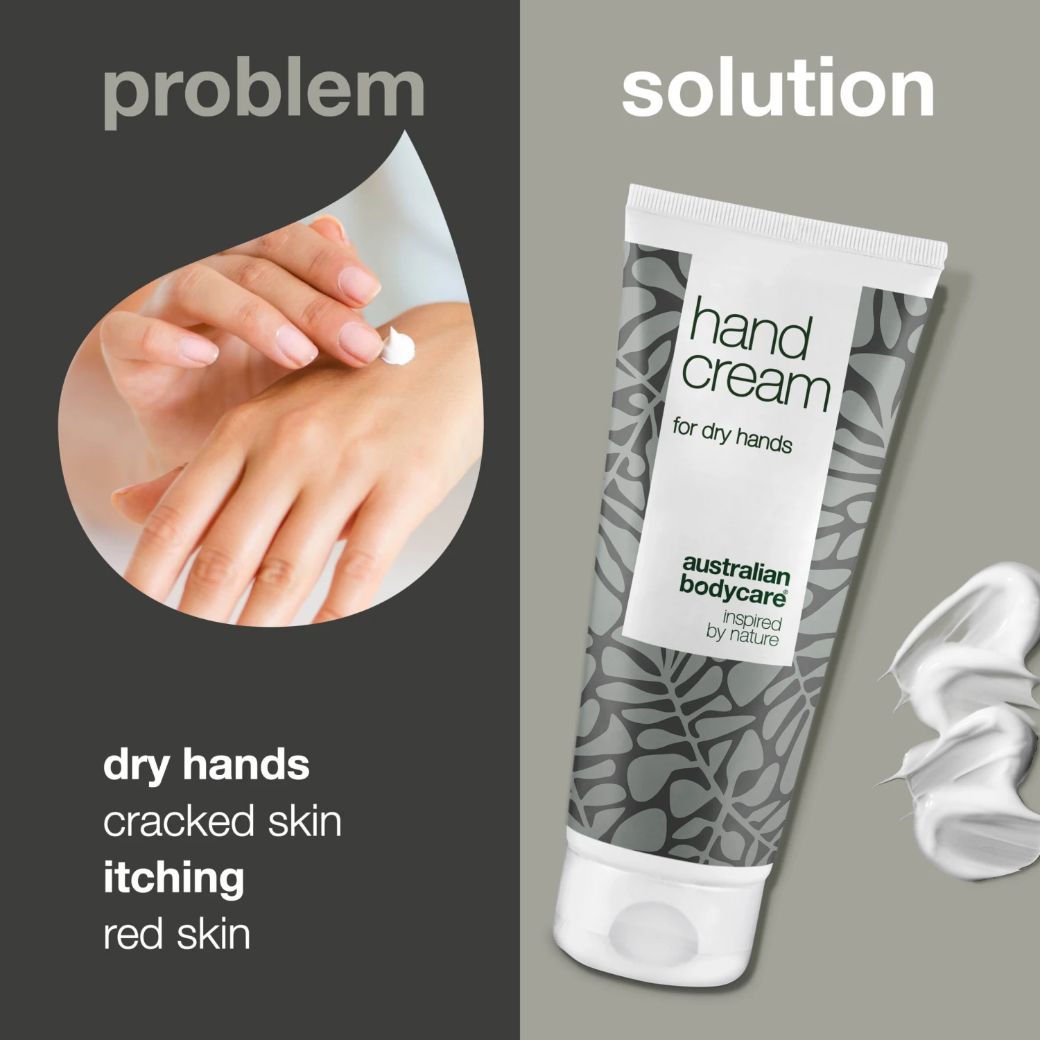 Australian Bodycare Tea Tree Hand Cream For Red And Dry Hands — Hand Lotion For The Daily Care Of Cracked, Itchy Hands Or With Red Skin - Image 2