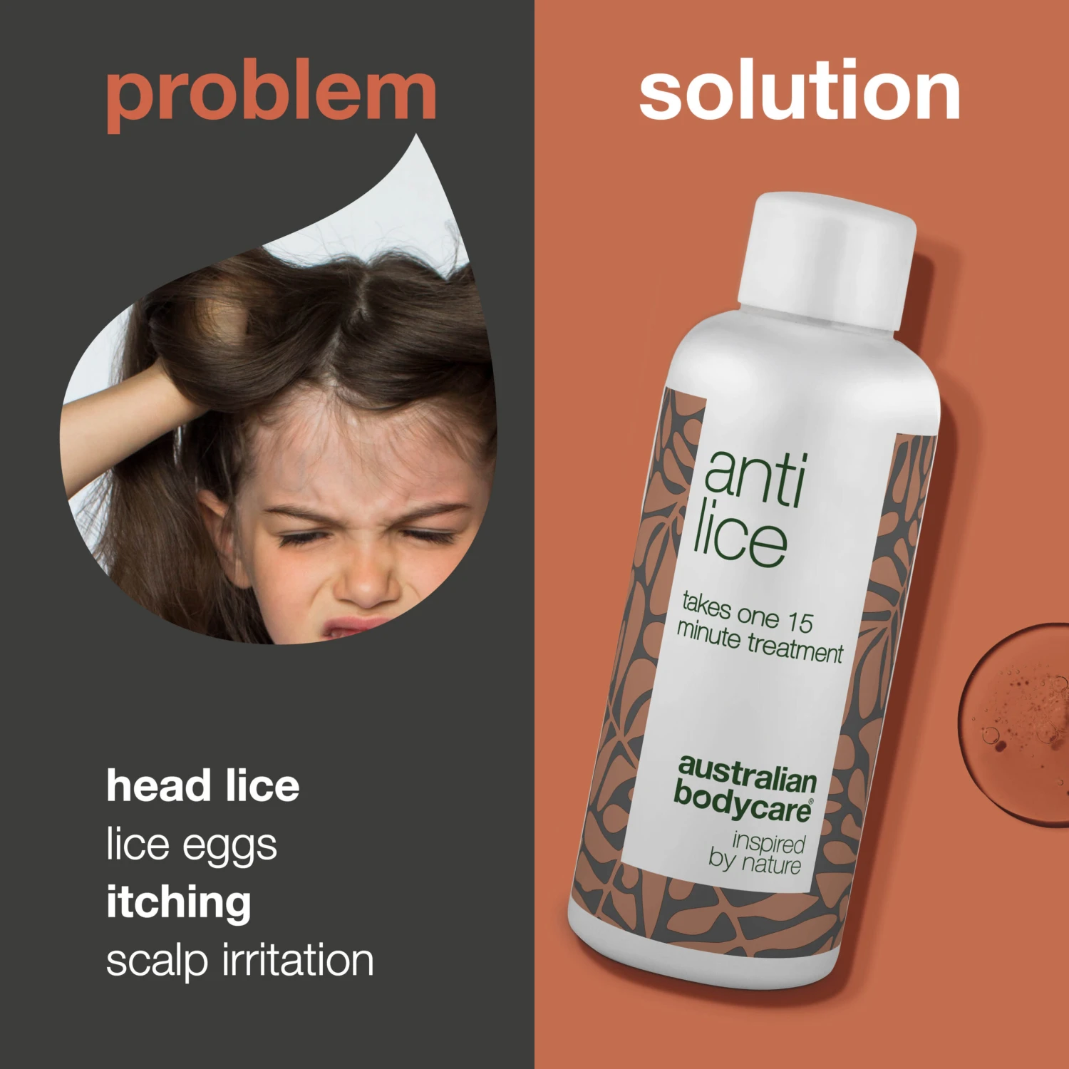 Australian Bodycare Lice Treatment-Effective Cure For Lice And Eggs In 15 Minutes — Non-toxic Lice Treatment With Natural Ingredients. Encapsulates And Suffocates Lice And Eggs. Paraben And Insecticide-free. - Image 2