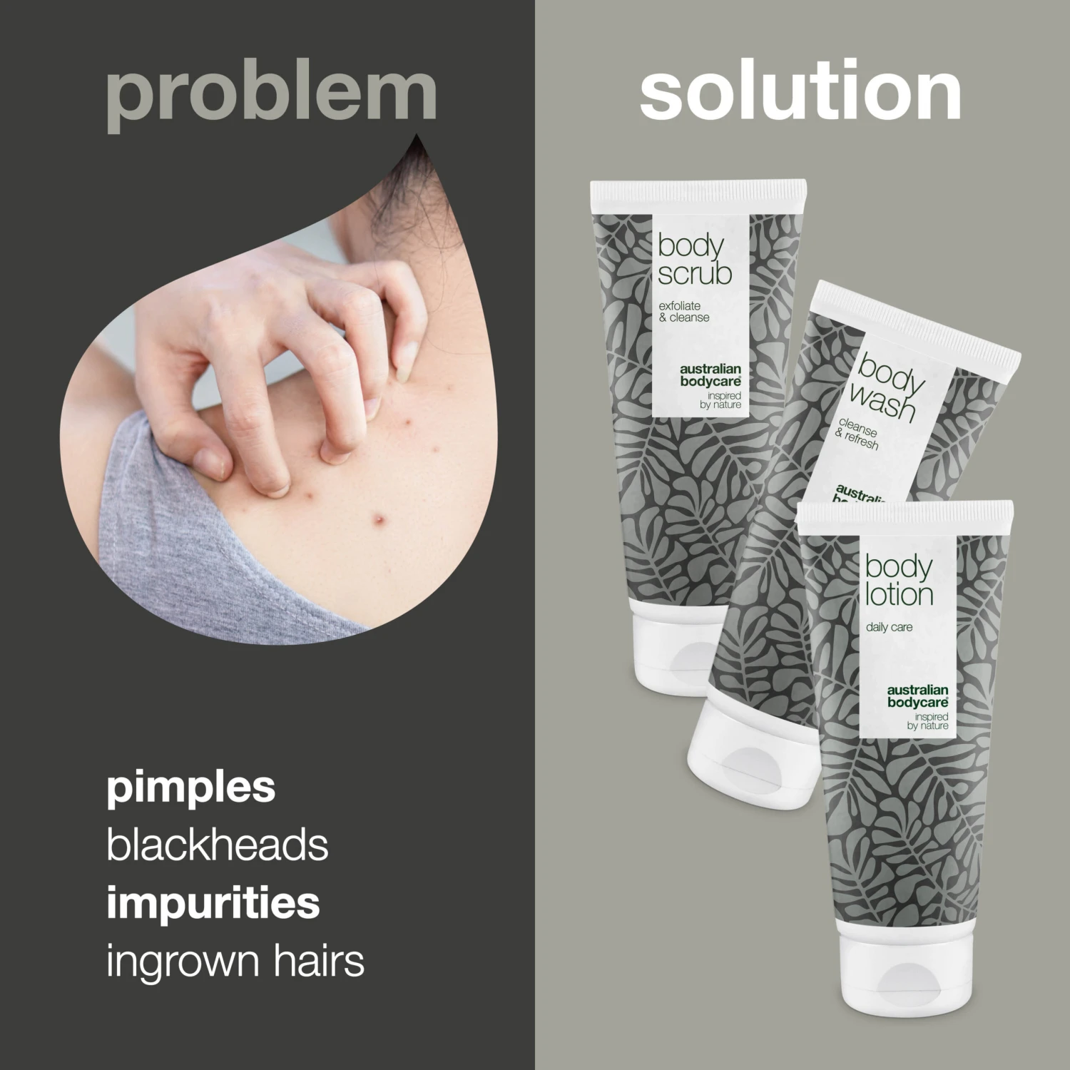 Australian Bodycare Skin Exfoliation Kit —3 Products That Reduce Sebum And Pimples - Image 2