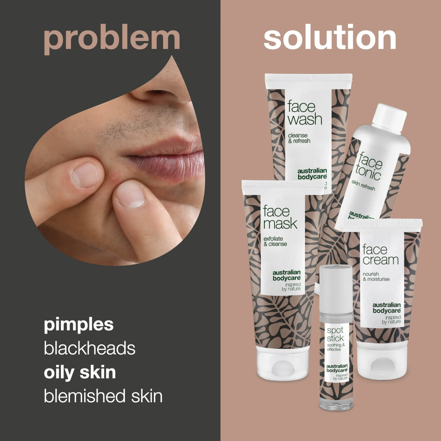 Australian Bodycare The Ultimate Face Pack For Blemished Skin — 5 Cleansing Products For Oily Skin With Pimples And Blackheads - Image 2