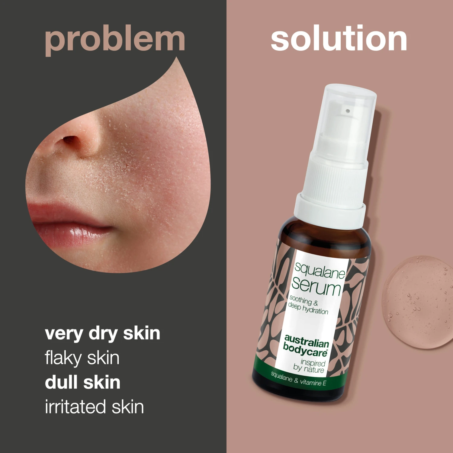 Australian Bodycare Moisturizing Face Serum With Squalane & Vitamin E — Squalane & Vitamin E Provide Deep Hydration For Dry Skin. A Lightweight, Non-greasy Serum That Leaves Your Skin Soft And Smooth. - Image 2
