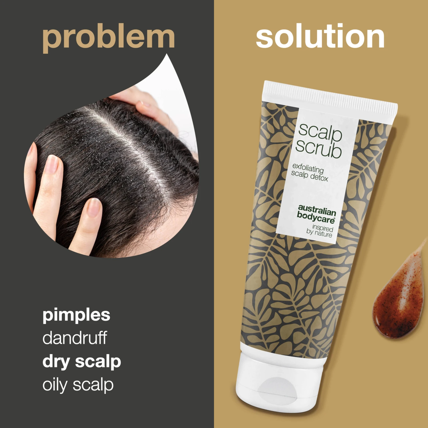 Australian Bodycare Exfoliating Scalp Scrub — Scalp Exfoliator For Pimples, Dandruff, Dry Or Oily Scalp - Image 2