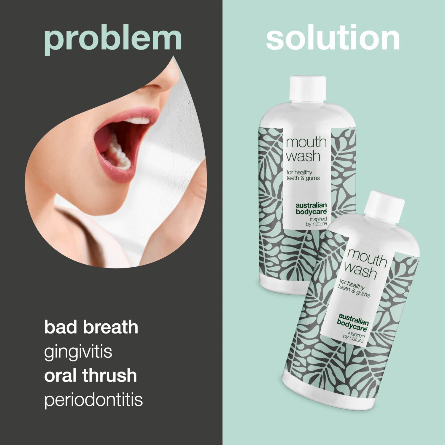 Australian Bodycare 2 X Mouthwash For Bad Breath And Bad Taste In The Mouth — For Daily Care Of Thrush And Gingivitis - Image 2