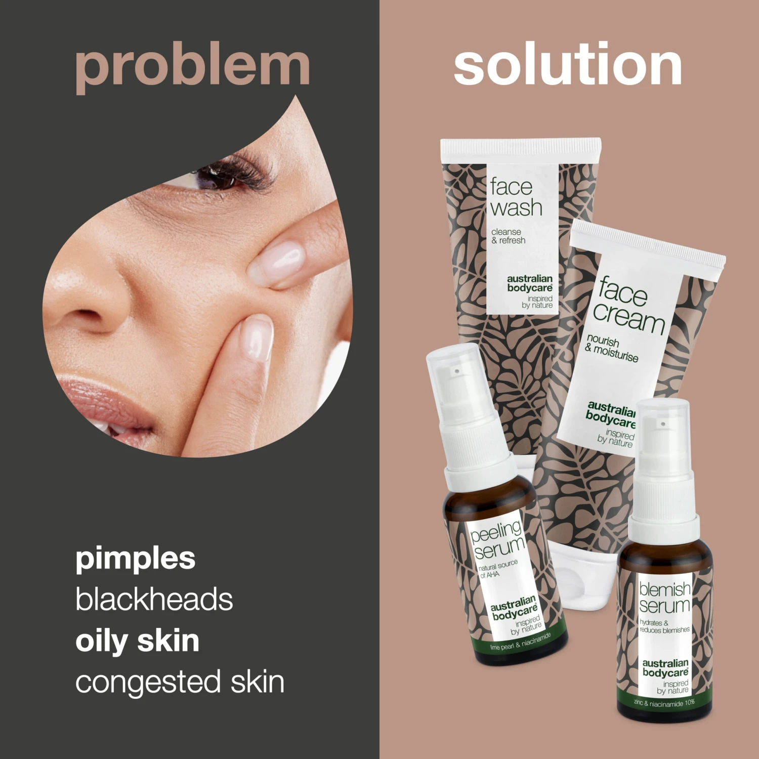 Australian Bodycare Skin Care Set For Congested Skin And Spots On Face — 4 Deep Cleansing Skin Care Products For Oily Skin, Pimples, And Blackheads - Image 2