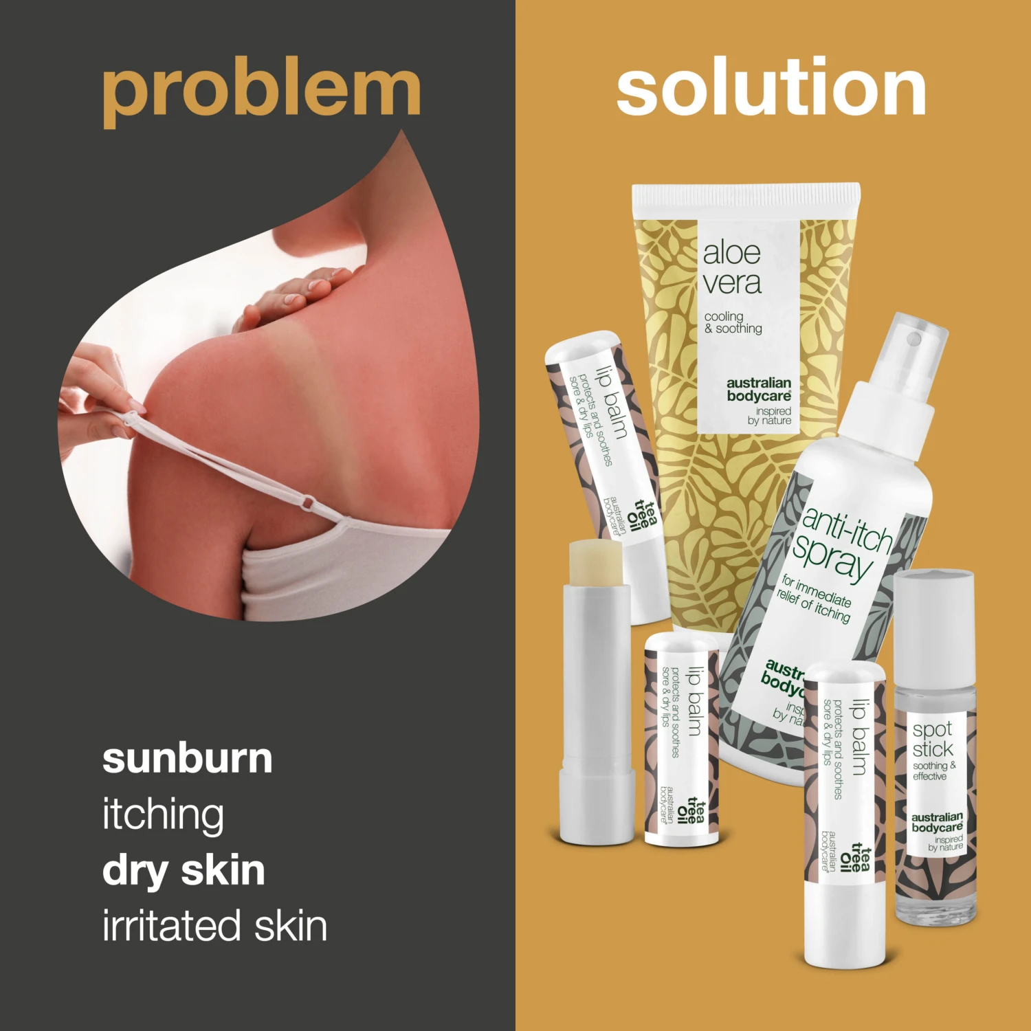 Australian Bodycare Summer Holiday Skin Care Products — Products To Care For Sunburn & Other Skin Problems - Image 2