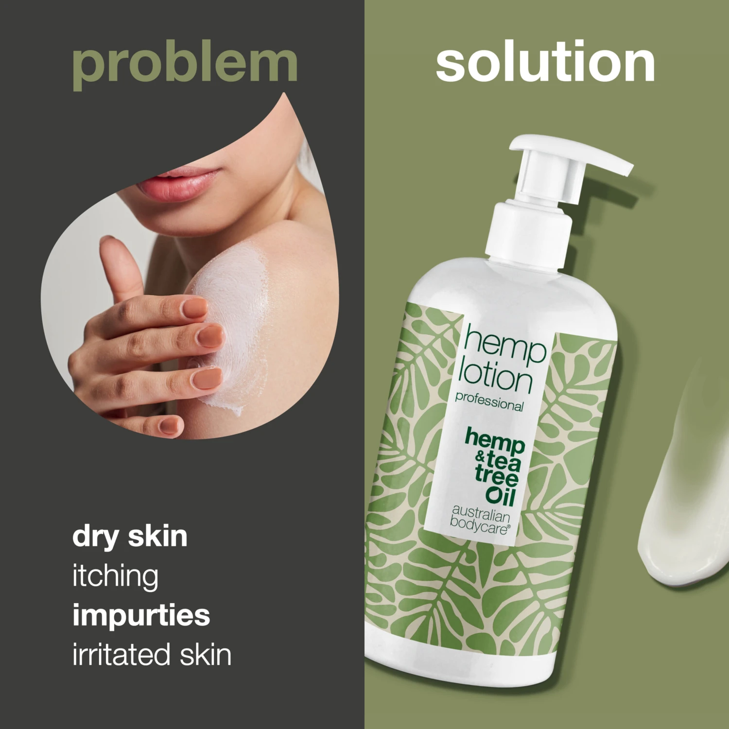 Australian Bodycare Hemp Body Lotion — Moisturizing Care For Dry Skin And Pimples On The Body - Image 2