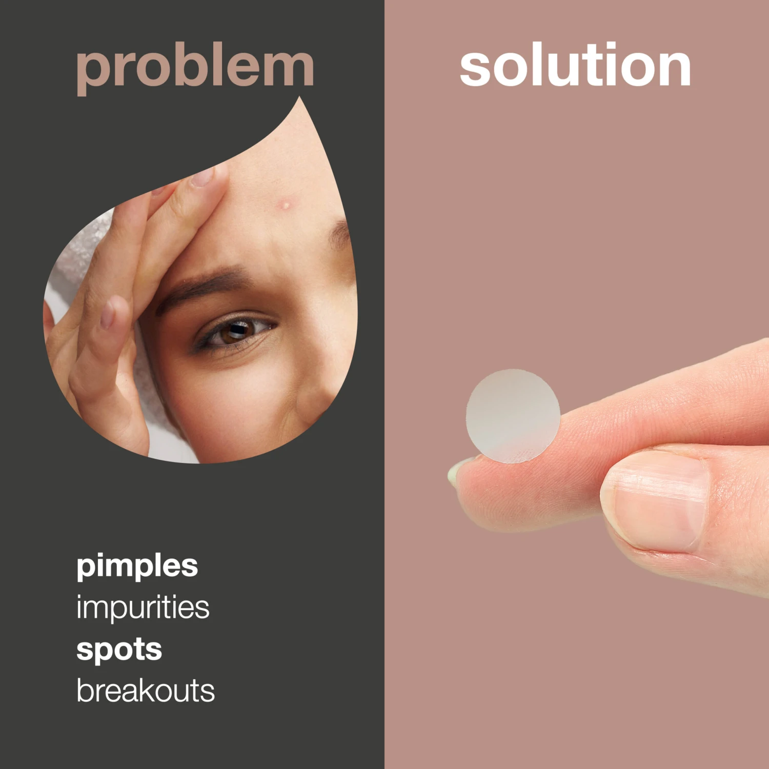 Australian Bodycare Pimple Patches For Spots — Effective Acne Patches With Hyaluronic Acid & Salicylic Acid - Image 2
