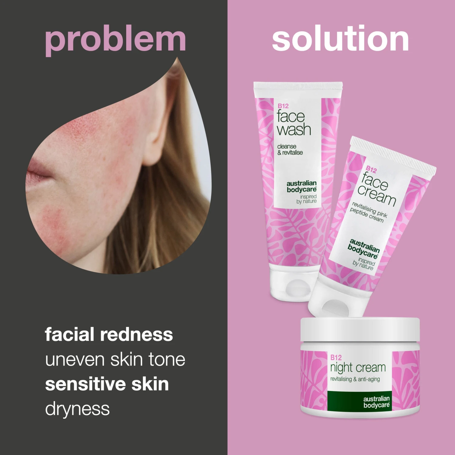 Australian Bodycare B12 Skincare Set For Redness – Cleanser, Day & Night Cream —B12 Skincare For Redness And Rosacea-prone Skin. Cleanser, Day Cream, And Night Cream That Soothe And Hydrate. - Image 2